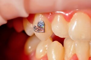 tooth jewellery