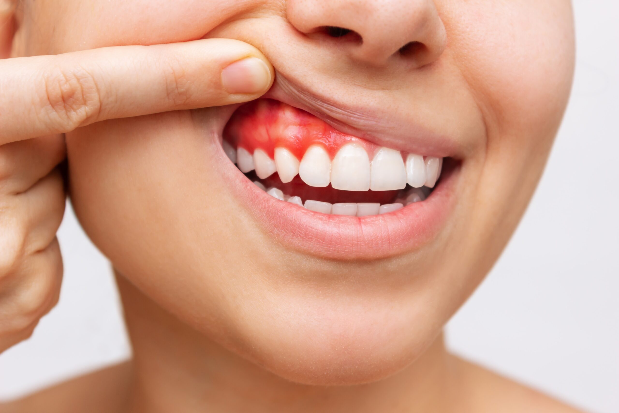 periodontal disease treatment