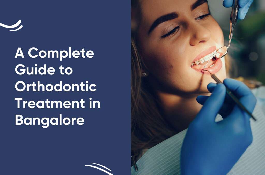 A Complete Guide to Orthodontic Treatment in Bangalore