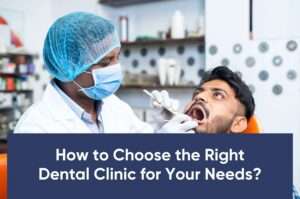 Best Dentist in Bangalore | Top Dental Clinic & Oral Care Guide