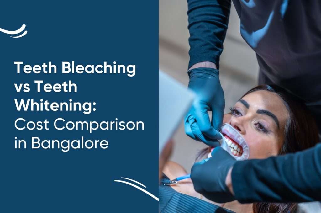 Teeth Bleaching Cost in Bangalore | Affordable Smile Whitening
