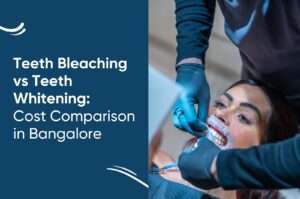 Teeth Bleaching Cost in Bangalore | Affordable Smile Whitening