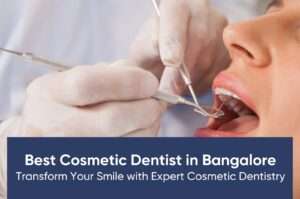 Best Cosmetic Dentist in Bangalore: Transform Your Smile with Expert Cosmetic Dentistry