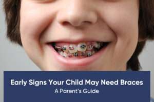Early Signs Your Child May Need Braces: A Parent’s Guide