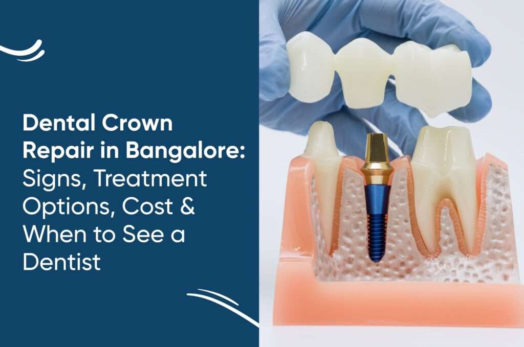 Dental Crown Repair in Bangalore: Signs, Treatment Options, Cost & When to See a Dentist