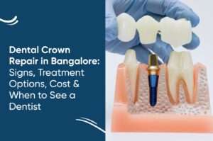 Dental Crown Repair in Bangalore: Signs, Treatment Options, Cost & When to See a Dentist
