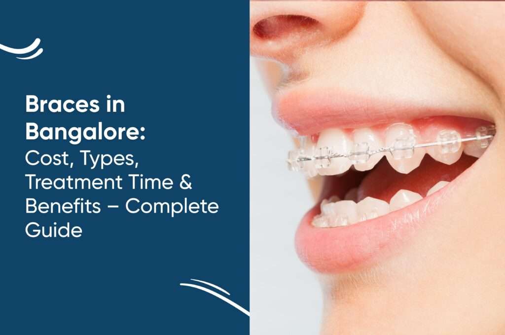 Braces in Bangalore: Cost, Types, Treatment Time & Benefits – Complete Guide