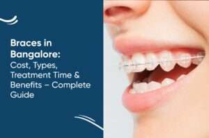 Braces in Bangalore: Cost, Types, Treatment Time & Benefits – Complete Guide